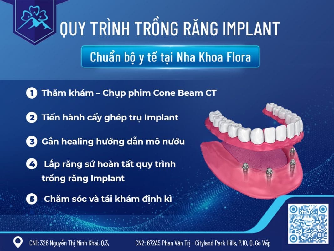 quy trình trồng răng Implant tại Nha Khoa Flora