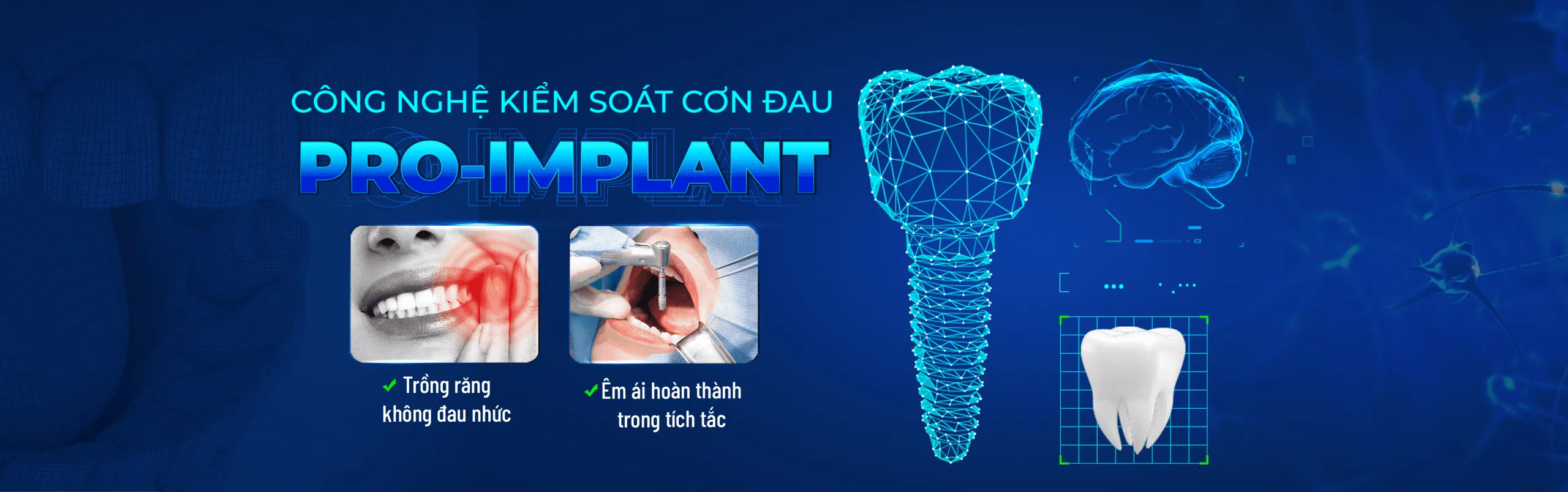 công nghệ kiểm soát cơn đau pro-implant