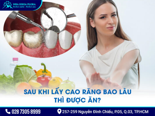 Lưu ý sau khi lấy cao răng - ảnh 3