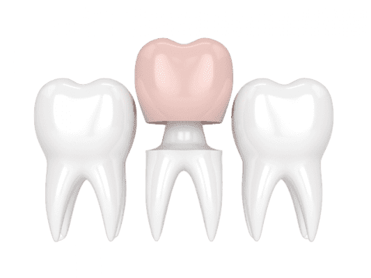 CHI PHÍ TRỒNG RĂNG IMPLANT TẠI NHA KHOA FLORA CẬP NHẬT 2025 4