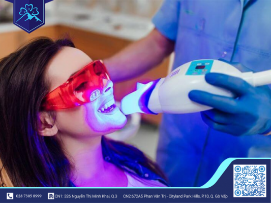 BẠN CÓ BIẾT NÊN TẨY TRẮNG RĂNG BAO NHIÊU LẦN MỘT NĂM? 3