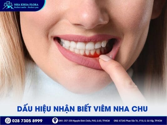 Viêm nha chu - ảnh 2