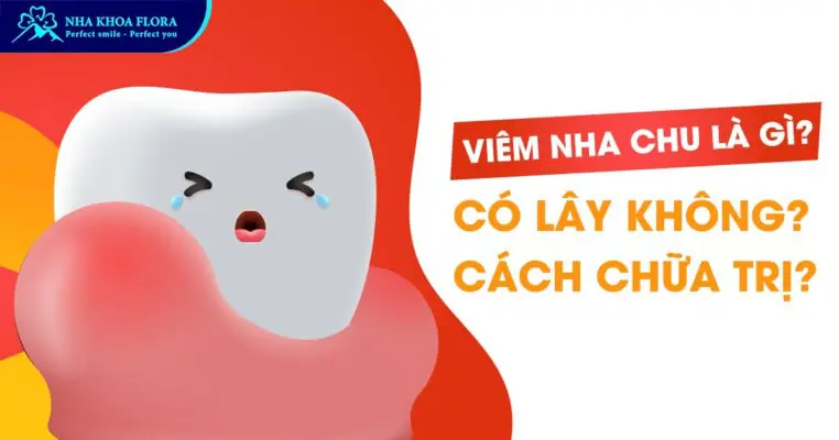 Viêm nha chu - Bệnh lý răng miệng không thể chủ quan 3