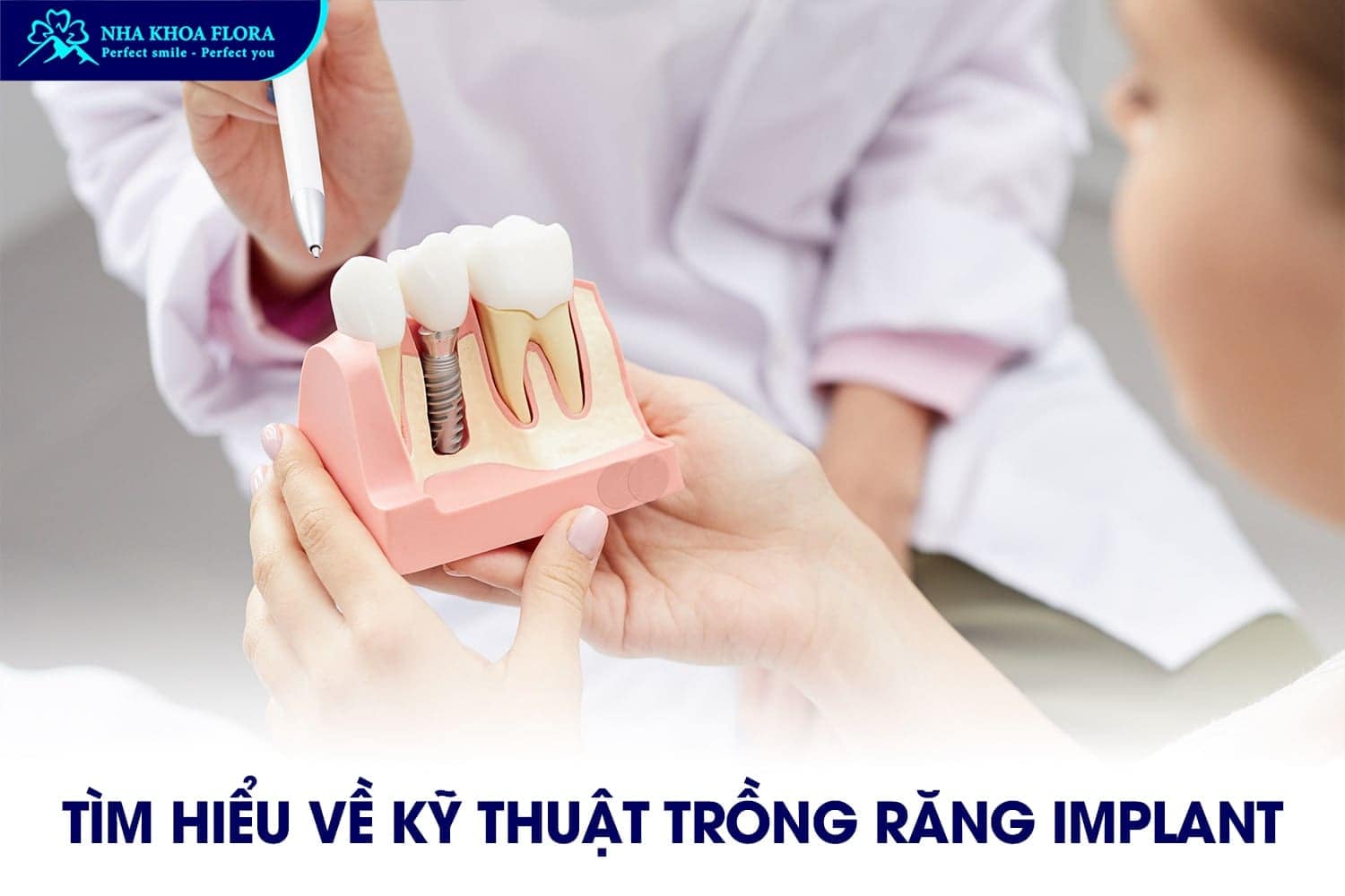 Trồng Răng Implant Có Bị Hôi Miệng Không? - ảnh 1 Trồng Răng Implant Có Bị Hôi Miệng Không? - ảnh 1