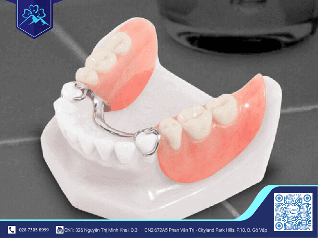 Răng tạm tháo lắp