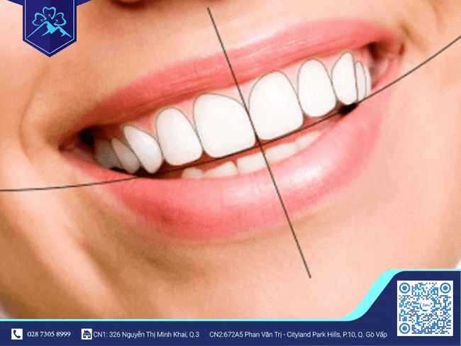 Khớp cắn chuẩn là như thế nào?