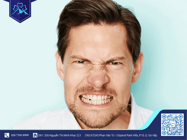 Mất răng do lực nghiến mạnh