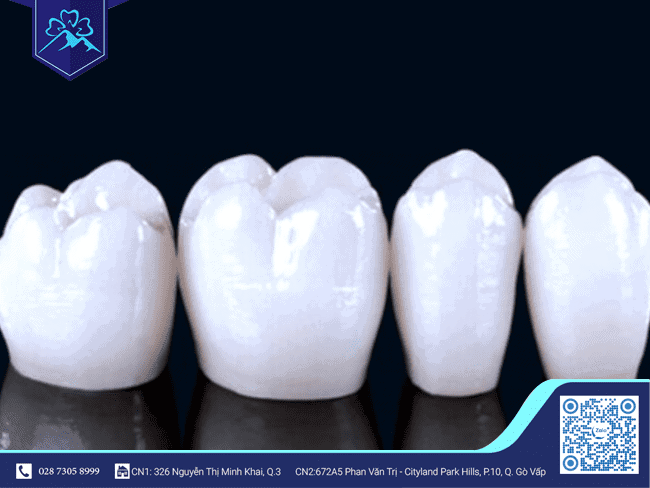 Lưu ý khi sử dụng răng tạm