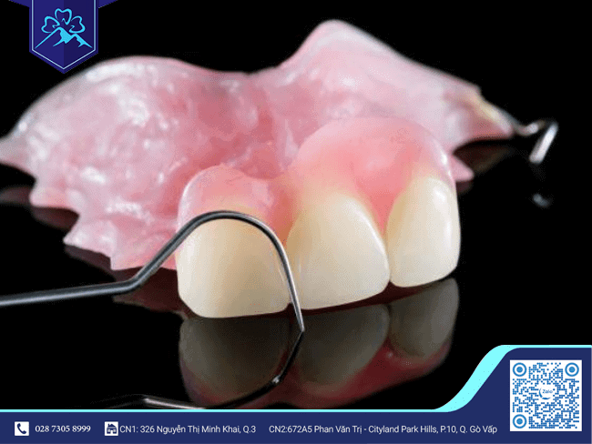 Răng tạm có thể tháo lắp 