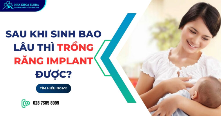 Sau khi sinh bao lâu thì trồng răng Implant được?