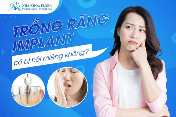 Trồng Răng Implant Có Bị Hôi Miệng Không? 5