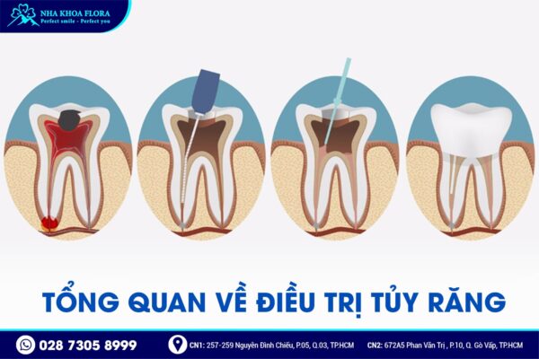 điều trị tủy có đau không - ảnh 1