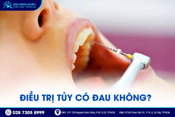 điều trị tủy có đau không - ảnh 2