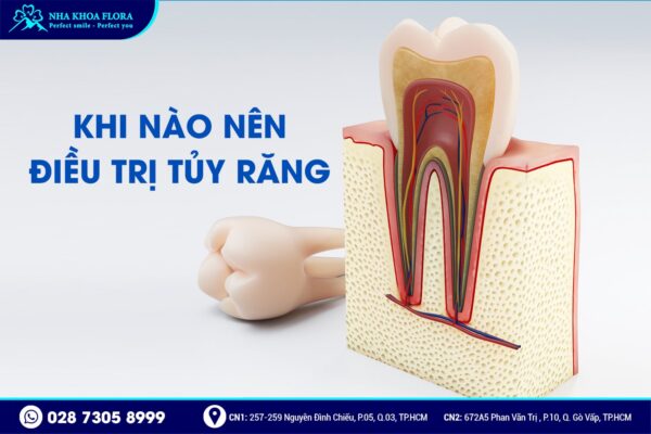 điều trị tủy có đau không - ảnh 3
