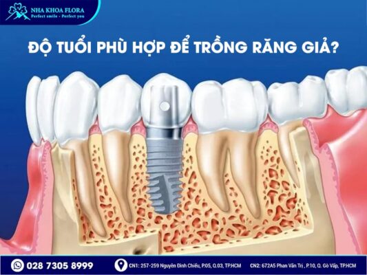 bao nhiêu tuổi mới trồng răng được - ảnh 1