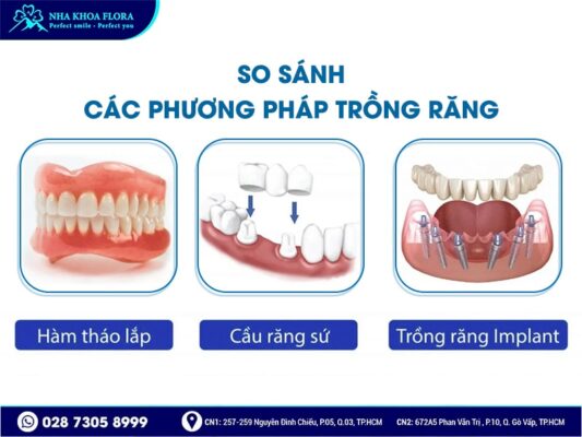 bao nhiêu tuổi mới trồng răng được - ảnh 2