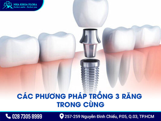 Gãy 3 răng trong cùng - ảnh 1