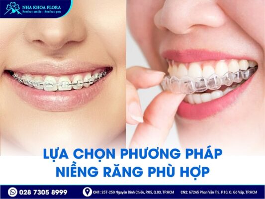 lưu ý khi niềng răng - ảnh 1