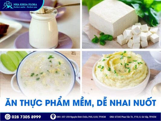 lưu ý khi niềng răng - ảnh 2
