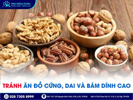 lưu ý khi niềng răng - ảnh 3