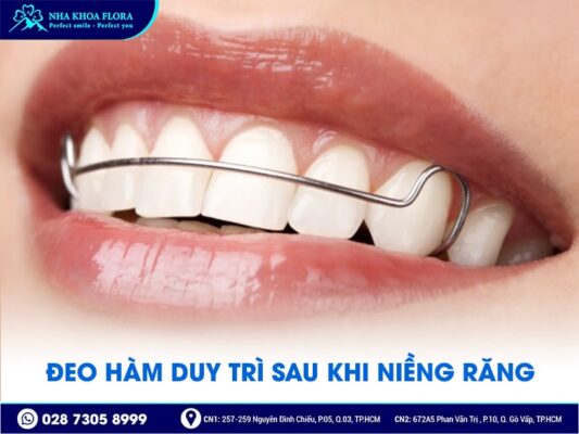 lưu ý khi niềng răng - ảnh 4