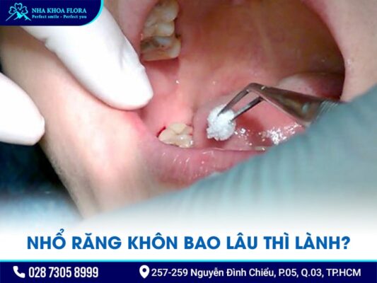 nhổ răng khôn bao lâu thì lành - ảnh 1