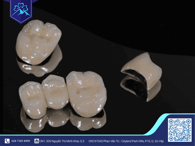 Cấu tạo của răng sứ