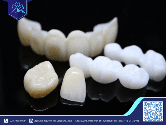 THAY MỚI RĂNG SỨ TRÊN IMPLANT ĐƯỢC KHÔNG? 4