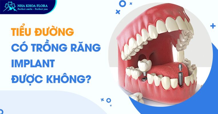tiểu đường có trồng răng Implant được không