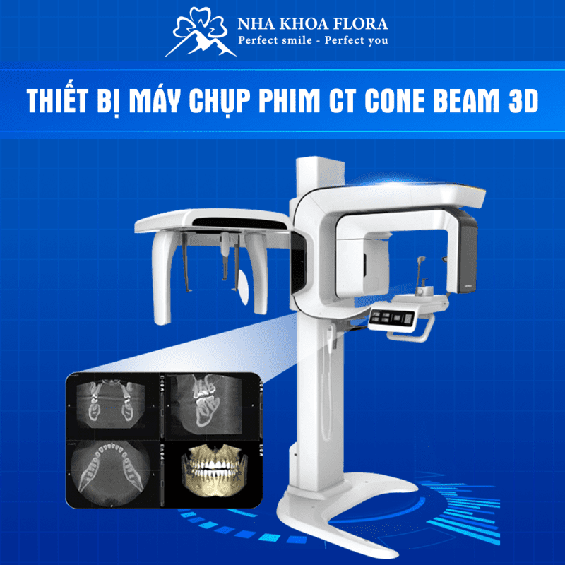 thiết bị nha khoa - máy chụp ct 3d con beam