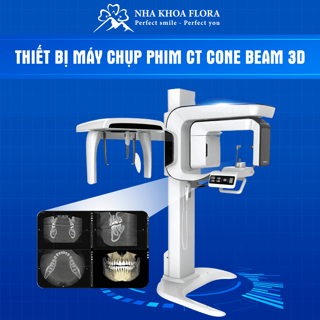 thiết bị nha khoa - máy chụp ct 3d con beam