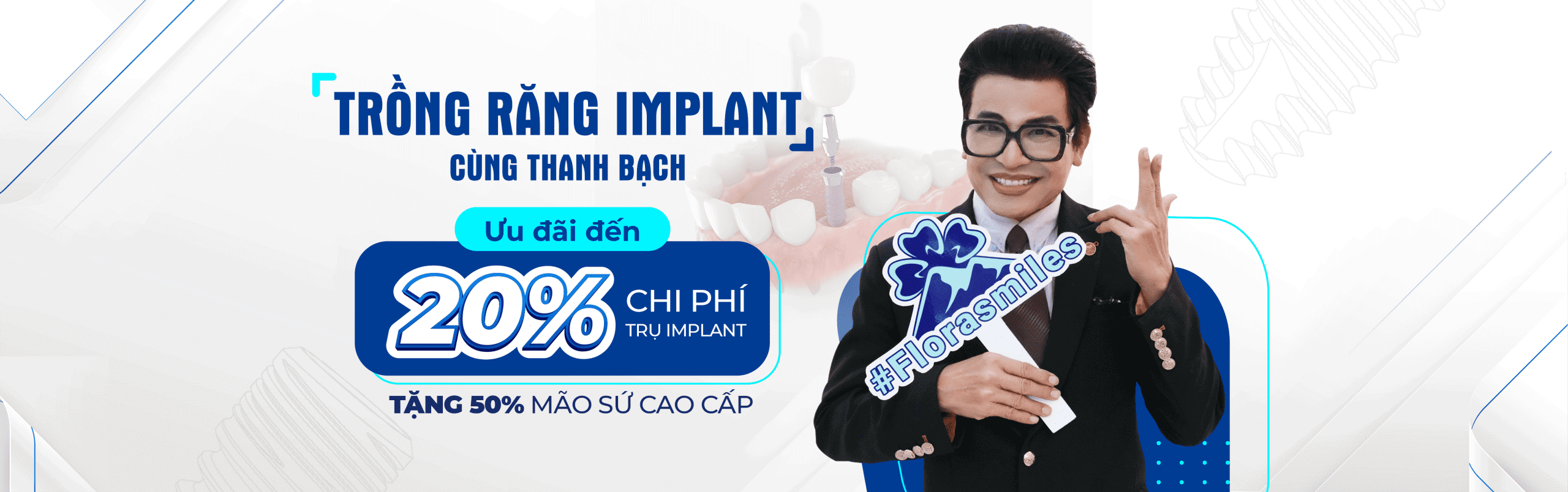 CHI PHÍ TRỒNG RĂNG IMPLANT TẠI NHA KHOA FLORA CẬP NHẬT 2025 1