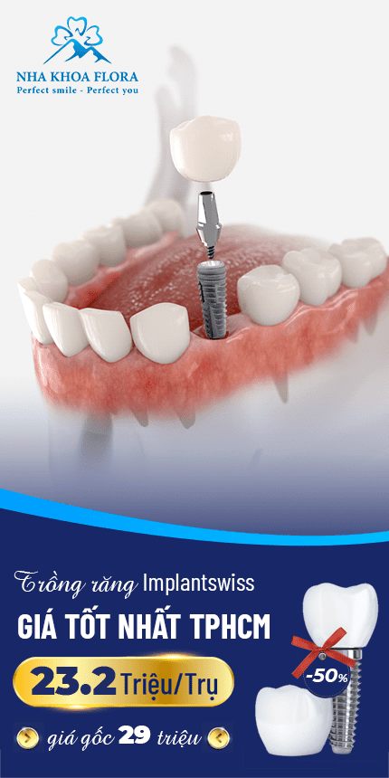 TRỒNG RĂNG IMPLANT LÀ GÌ? TẤT CẢ NHỮNG ĐIỀU BẠN CẦN BIẾT 2