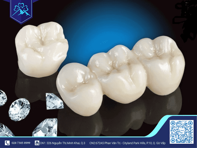 Răng sứ Diamond