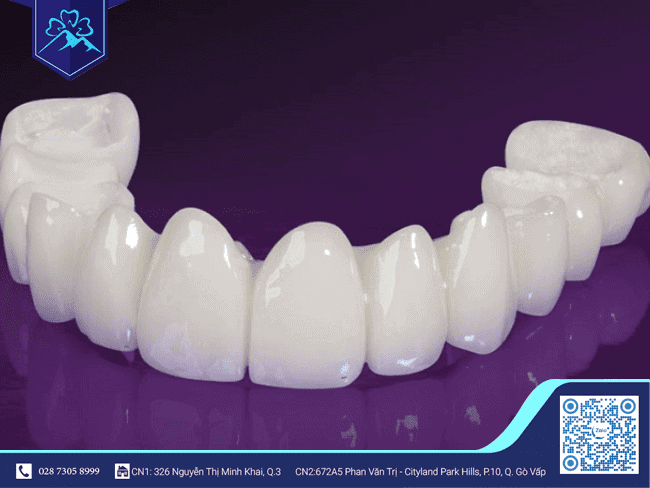 Răng sứ Lava Plus