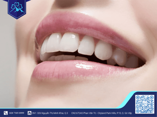 Cập Nhập Ngay Xu Hướng Bọc Răng Sứ Mùa Lễ Hội 2