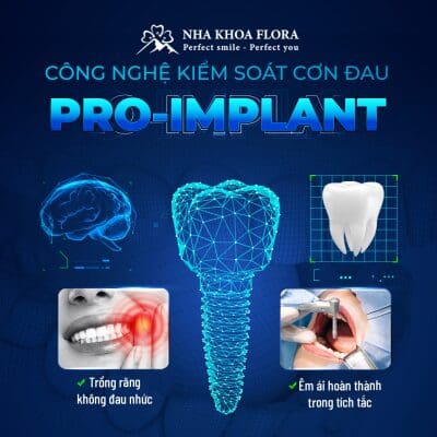 Dịch vụ trồng răng Implant
