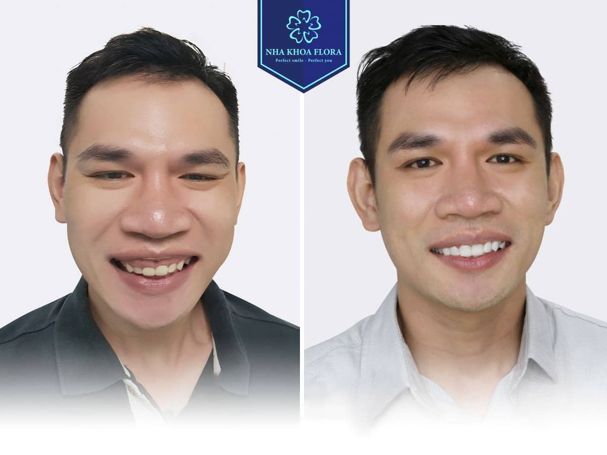 THƯ VIỆN NỤ CƯỜI 4