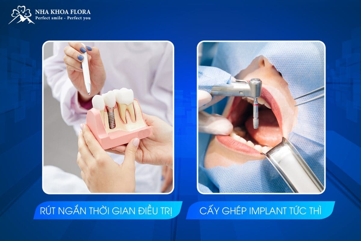 Ứng Dụng Laser Trong Cấy Ghép Implant 3