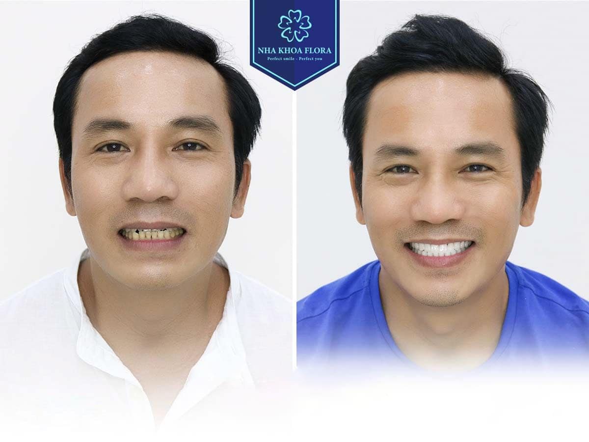 THƯ VIỆN NỤ CƯỜI 5