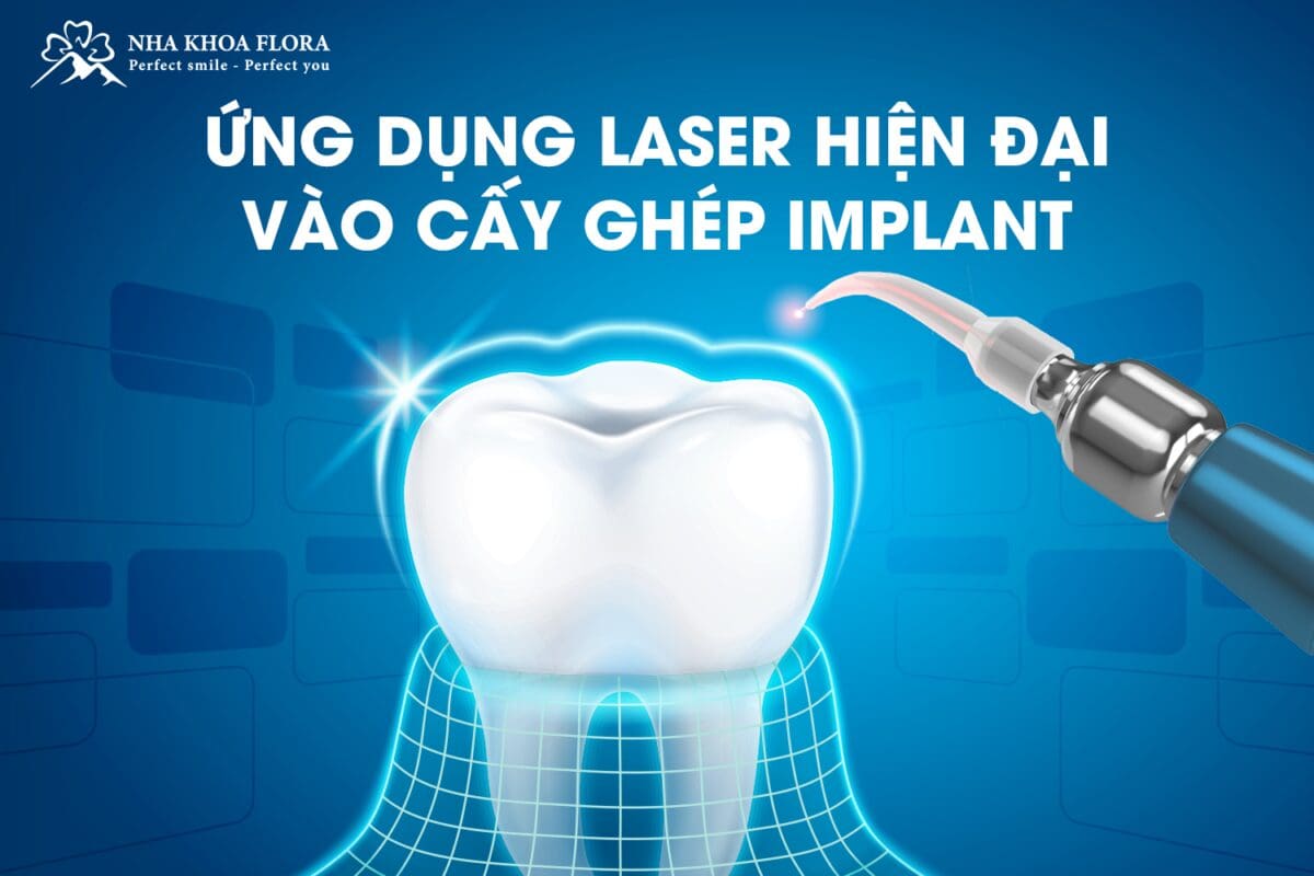 Ứng Dụng Laser Trong Cấy Ghép Implant 1