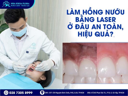 làm hồng nướu bằng Laser - ảnh 4