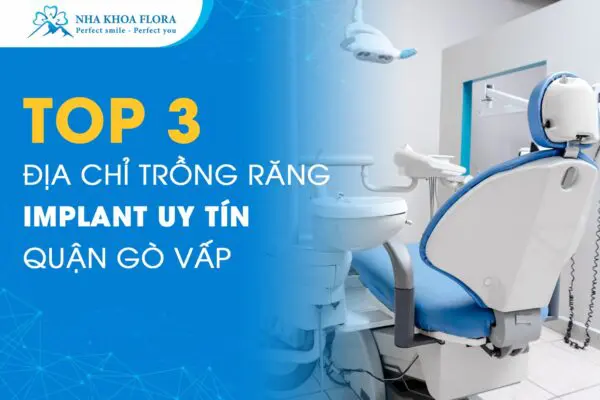 Top 3 Địa Chỉ Trồng Răng Implant Uy Tín Quận Gò Vấp 3
