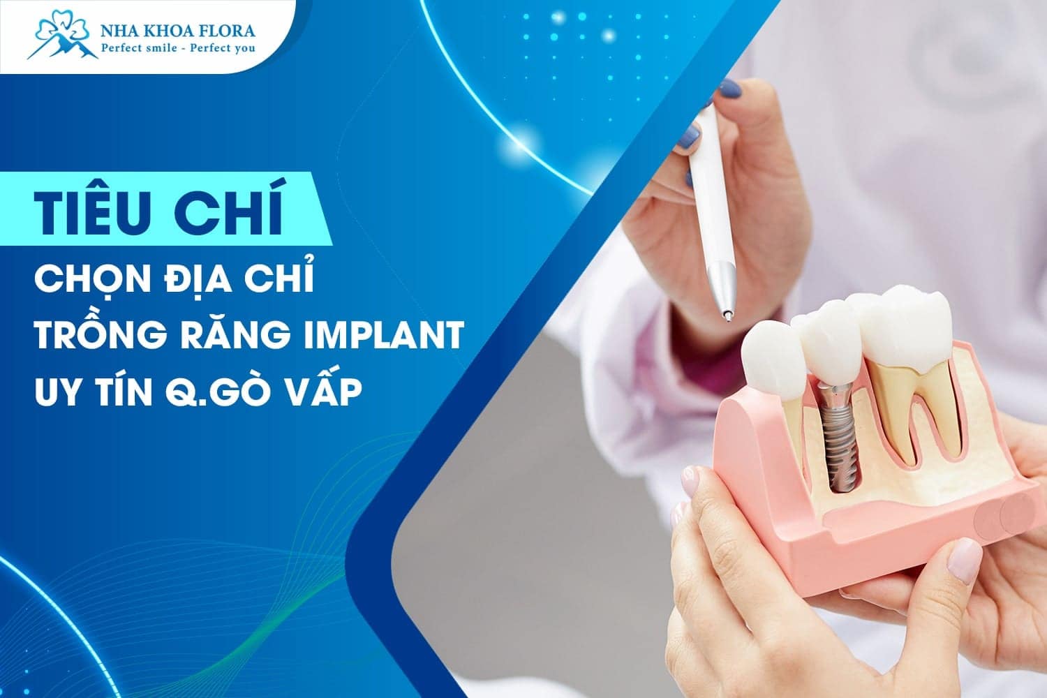 Top 3 Địa Chỉ Trồng Răng Implant Uy Tín Quận Gò Vấp - ảnh 1