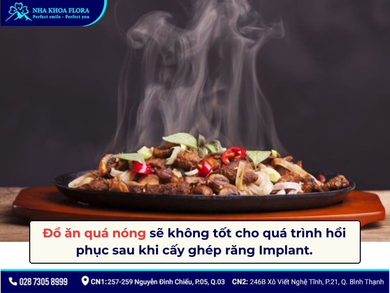 kiêng gì khi cắm răng implant