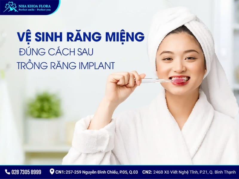 kiêng gì khi cắm răng implant