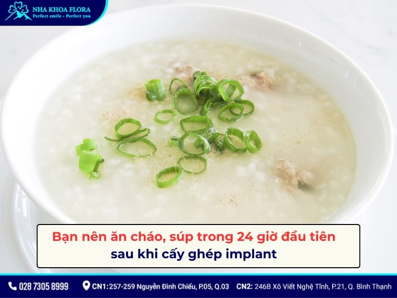 kiêng gì khi cắm răng implant