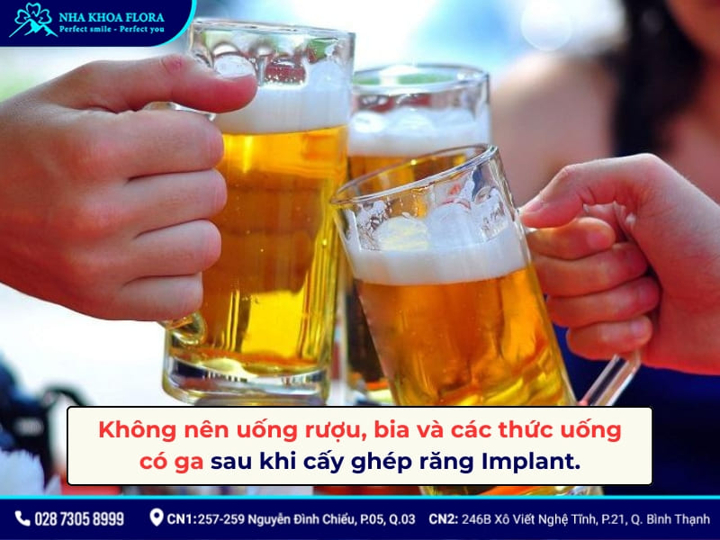 kiêng gì khi cắm răng implant