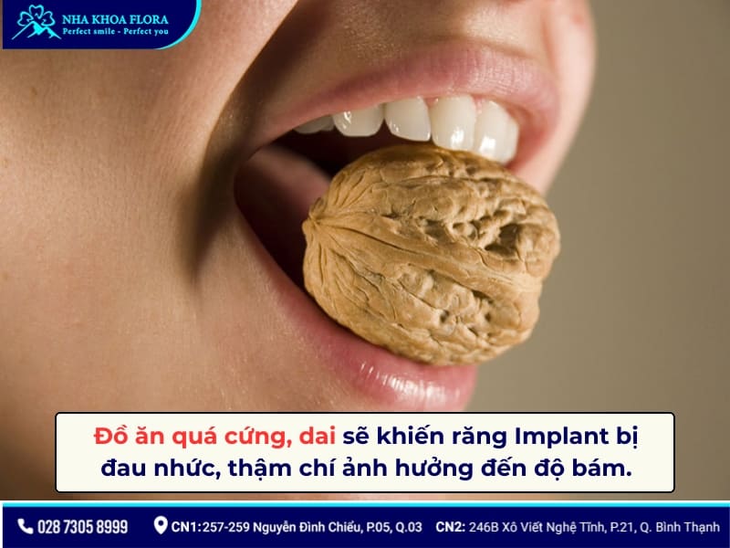 kiêng gì khi cắm răng implant