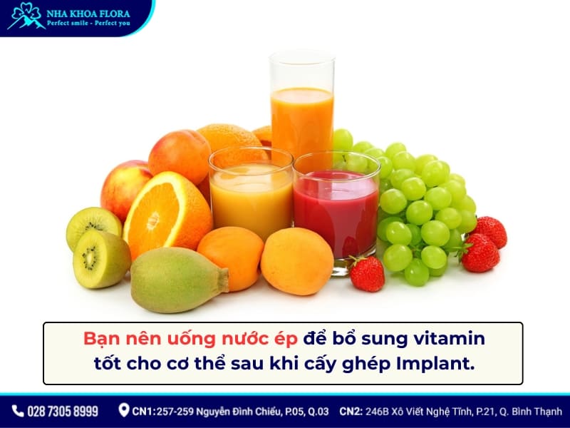 kiêng gì khi cắm răng implant